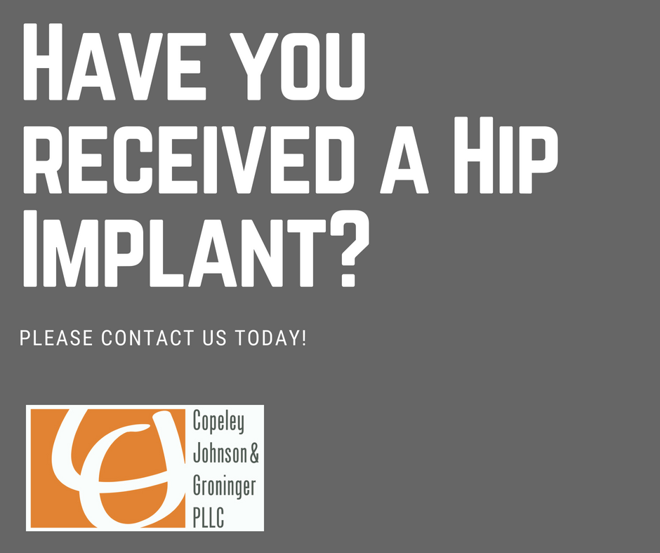 Have you received a Hip Implant? 1