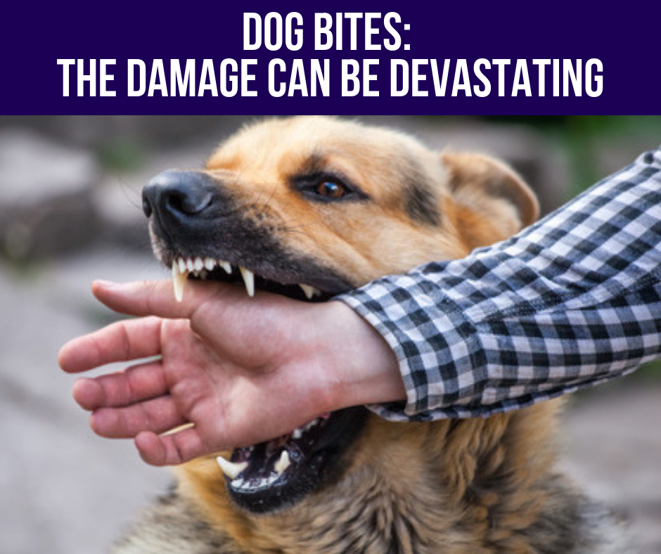 Dog Bites: The Damage Can Be Devastating 1